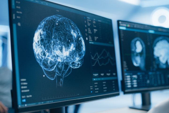 Medical Brain Scans on Multiple Computer Screens. Advanced Neuroimaging Technology Reveals Complex Neural Pathways, Display Showing CT Scan in a Modern Medical Environment