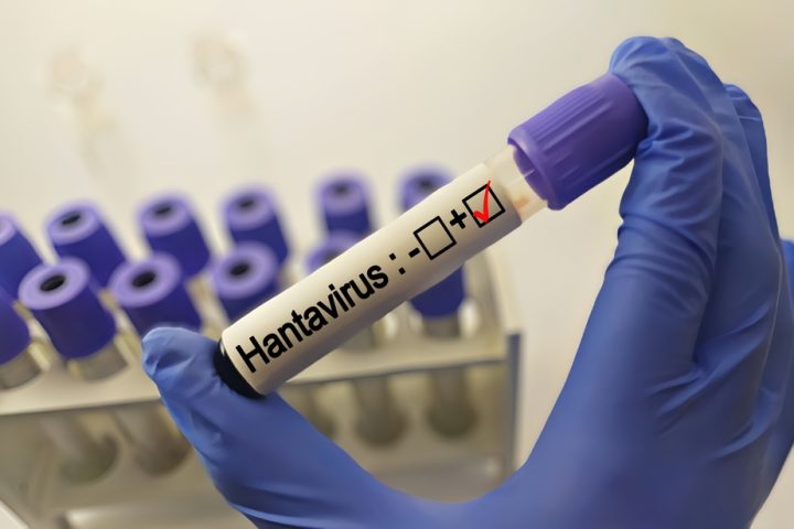 spain-confirms-new-hantavirus-case