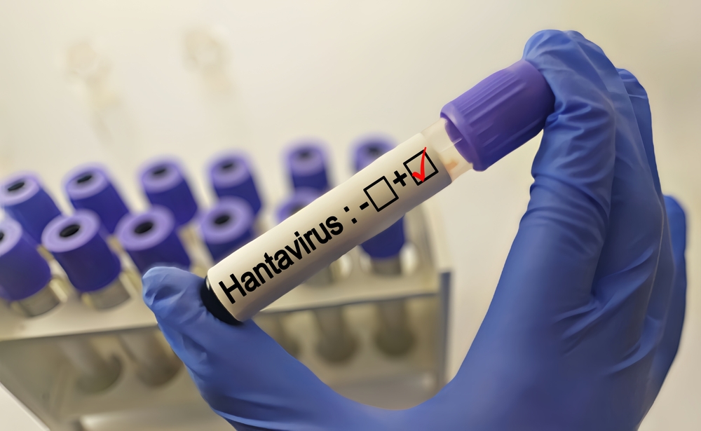 spain-confirms-new-hantavirus-case