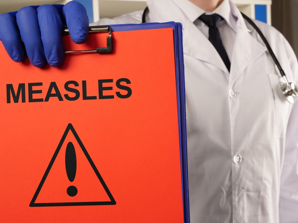 santa-barbara-confirms-measles-case
